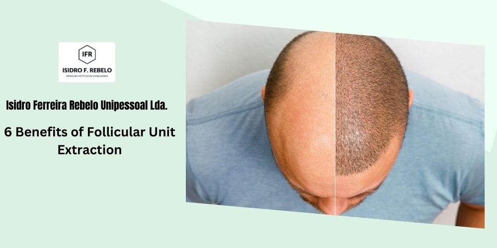 6 Benefits of Follicular Unit Extraction