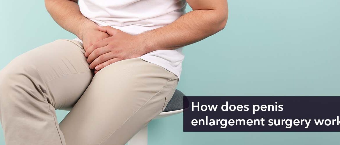 Penis Enlargement Surgery: How It Works, Pros & Cons