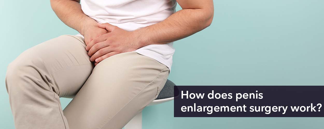 Penis Enlargement Surgery: How It Works, Pros & Cons